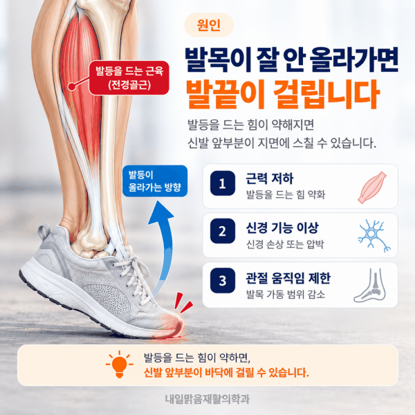 발목을 들어 올리는 근육과 신경 기능 저하로 발끝이 걸리는 원리